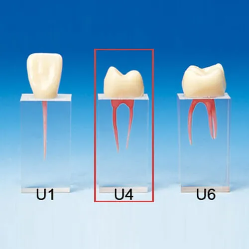 S3-U4, Root Canal Model