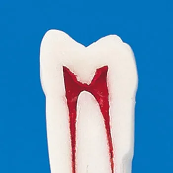 A12AN-200, Endodontic Tooth Model #14
