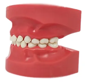 Nissin Pediatric Dental Model، أسنان مختلطة، 24 سنًا، لثة صلبة