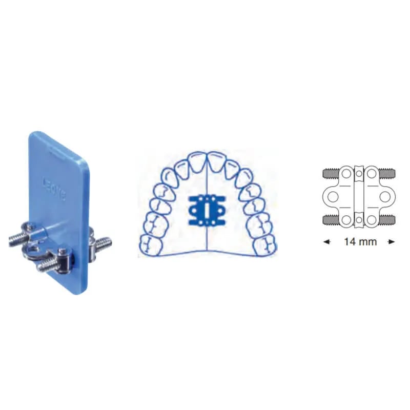 Bi-Fan Type Special Expansion Screw, 14mm